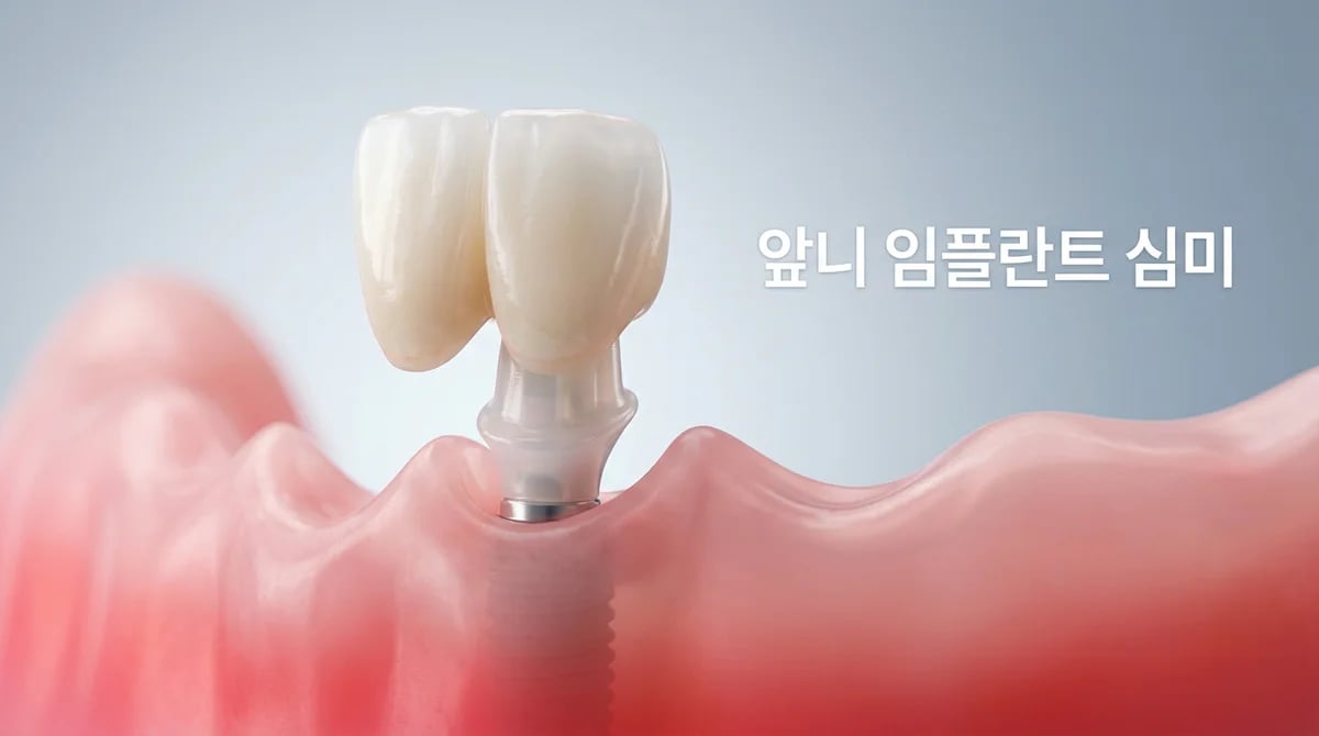 자연스러운 앞니 임플란트: 심미성 높이는 3가지 핵심 요소와 가이드
