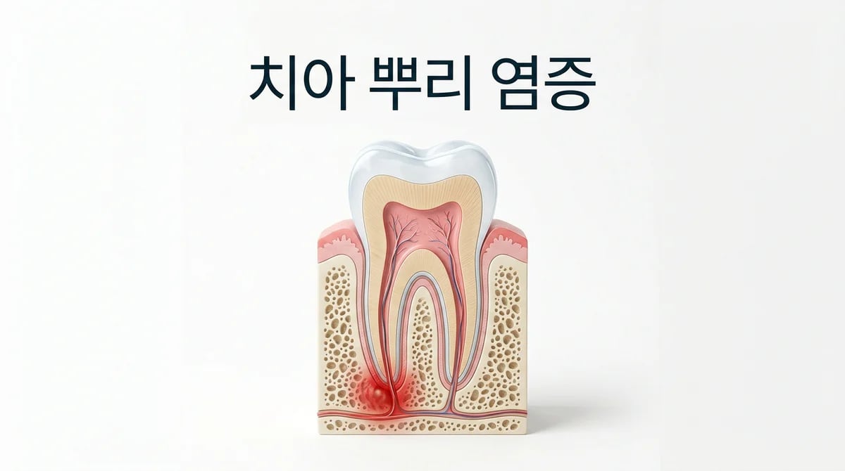 치아 뿌리 염증(치근단낭) 증상 진단부터 치료법까지 완벽 가이드