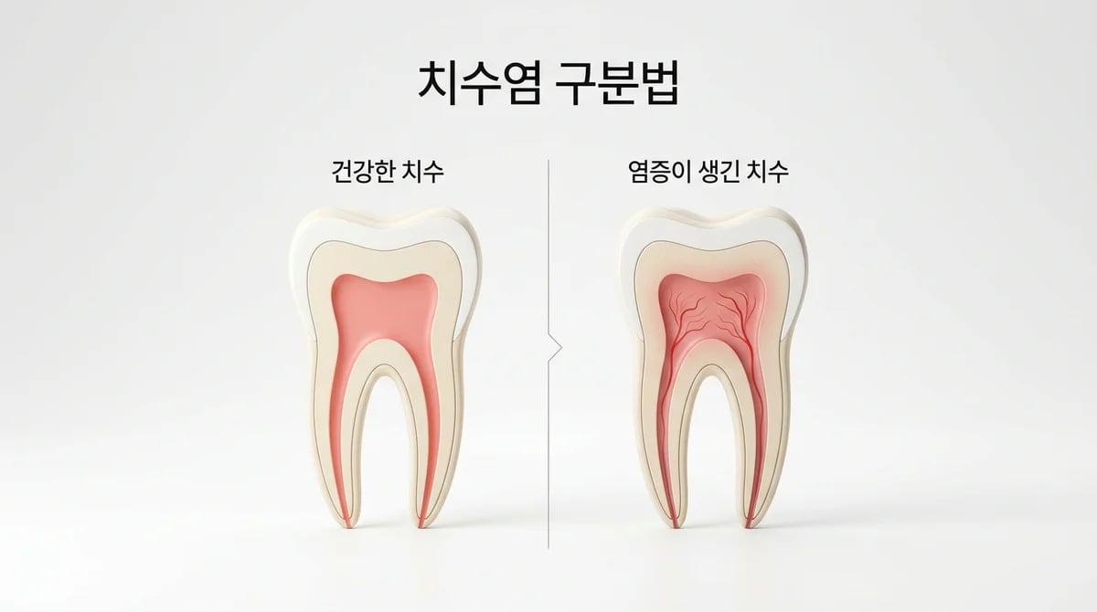 치수염 종류: 가역성 vs 비가역성 4가지 핵심 차이점과 진단법