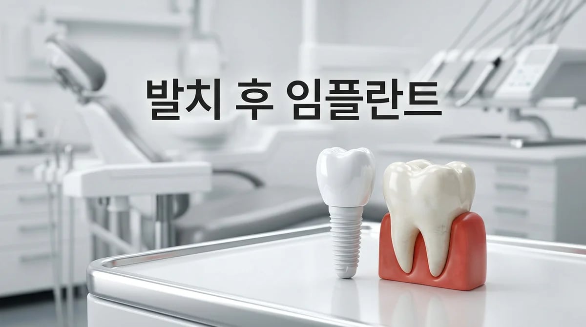 제2대구치 발치 후 임플란트: 빈 공간의 영향과 치료 과정 고려사항