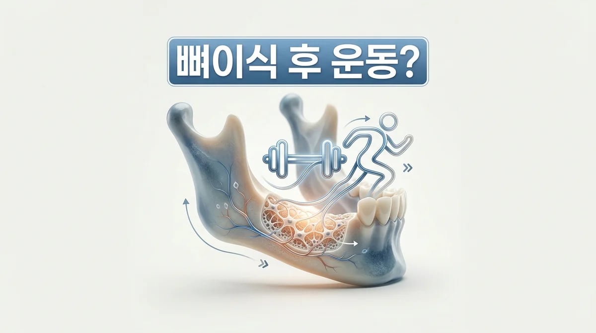 치과 뼈이식 후 안전한 운동 재개 가이드: 회복 단계별 주의사항
