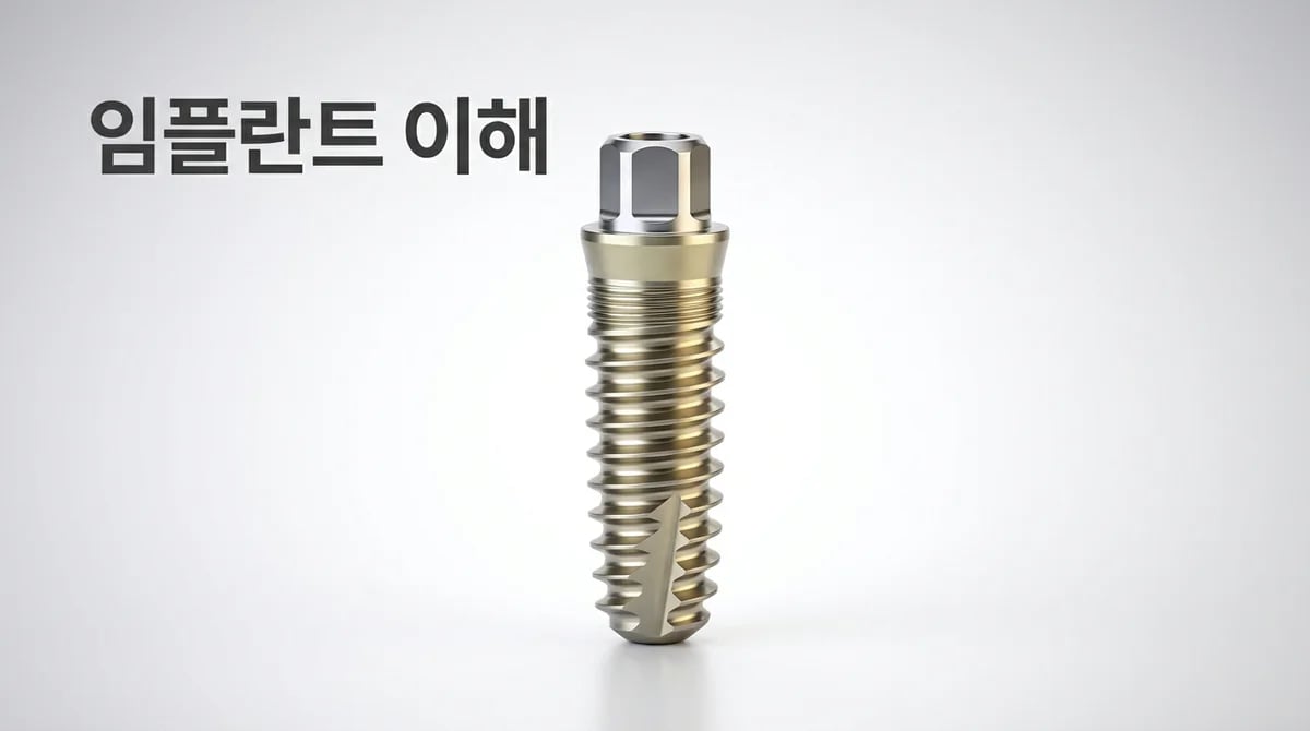 치과 임플란트: 스트라우만 시스템의 주요 기술과 특징 이해