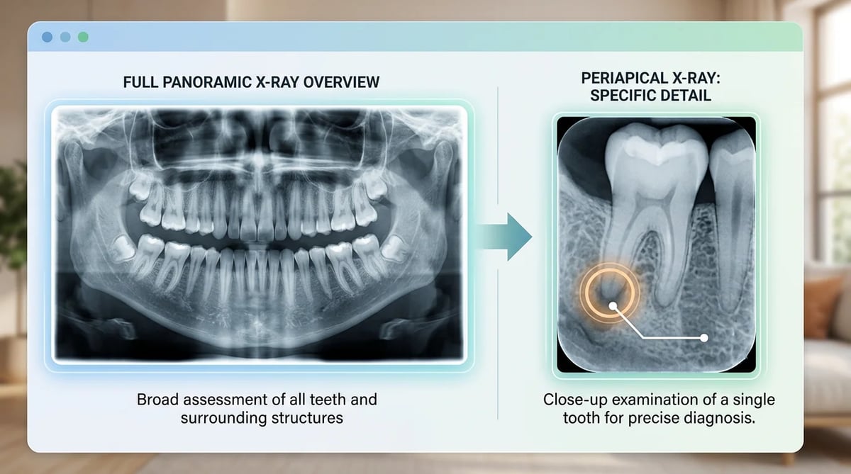 파노라마 및 치근단 X-ray 이미지를 통해 본 치아 진단 과정