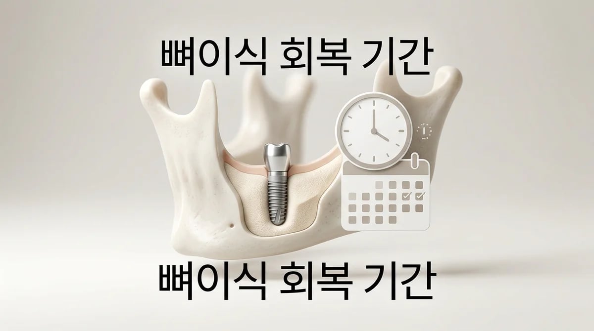 임플란트 뼈이식 후 회복 기간: 3~6개월, 시기별 로드맵과 관리법