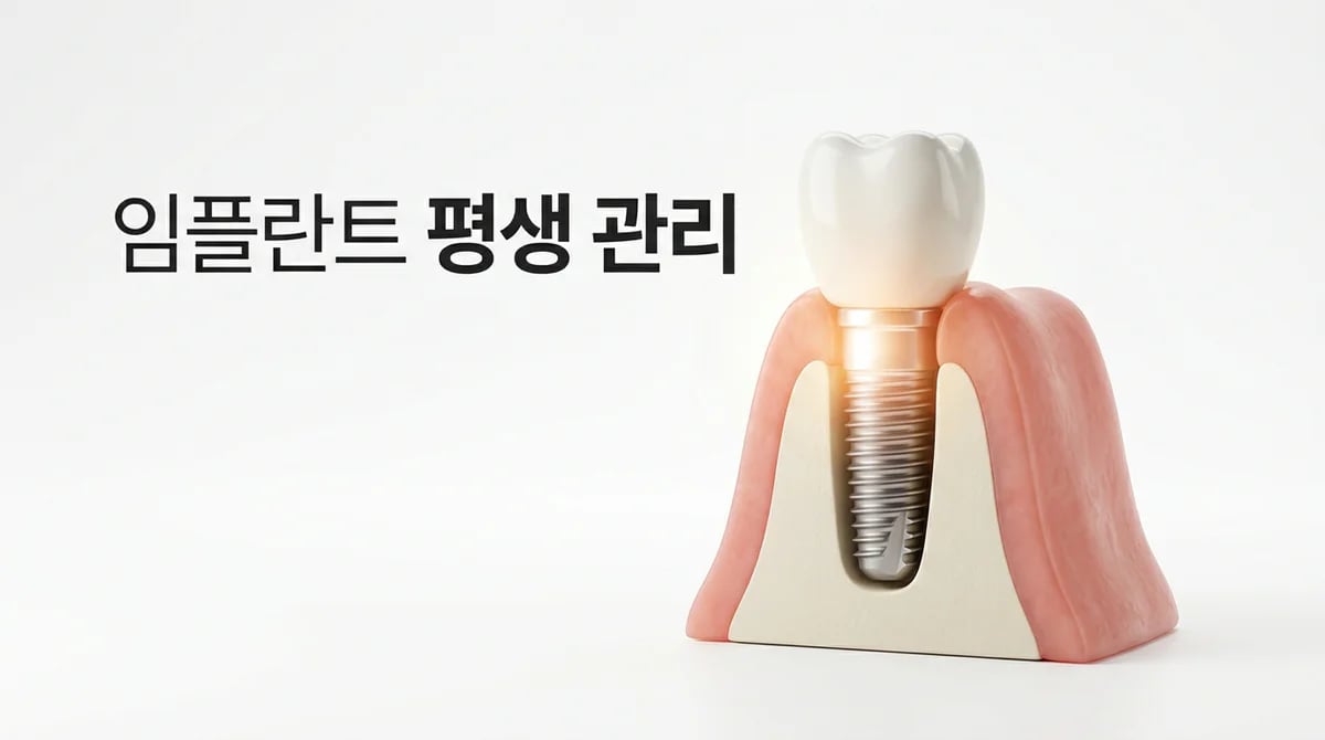 임플란트 주위염 예방: 건강한 임플란트 수명 연장을 위한 관리 가이드