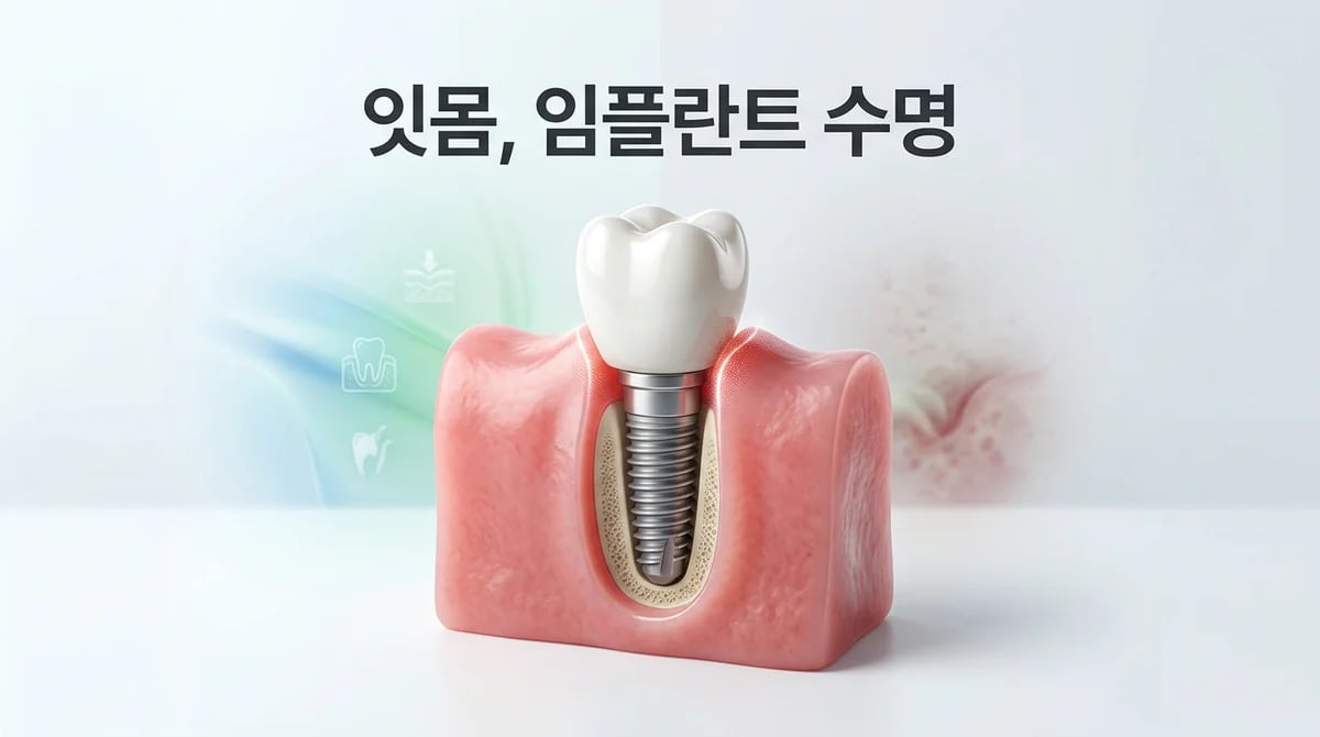임플란트 오래 유지하는 비밀: 잇몸 건강 관리의 중요성