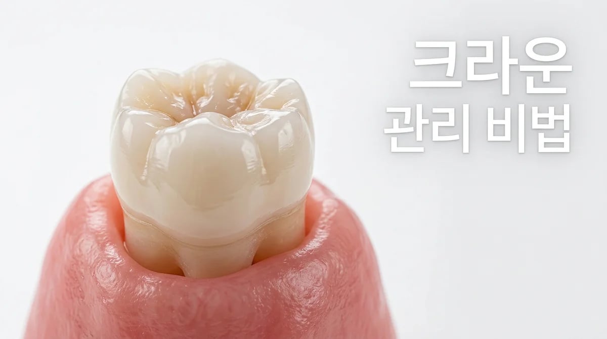 크라운 치아 관리 비결: 오래 건강하게 사용하는 5가지 핵심 원칙