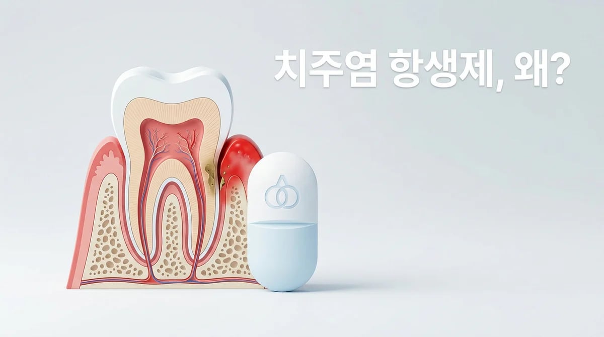 치주염 치료 항생제: 사용 원리 및 기계적 치료 우선 이유 3가지