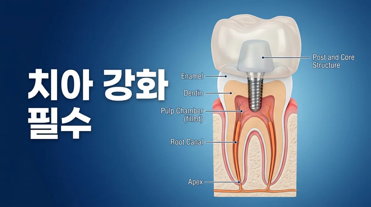 신경치료 후 약해진 치아, 코어 재료별 강화 방법 완벽 가이드