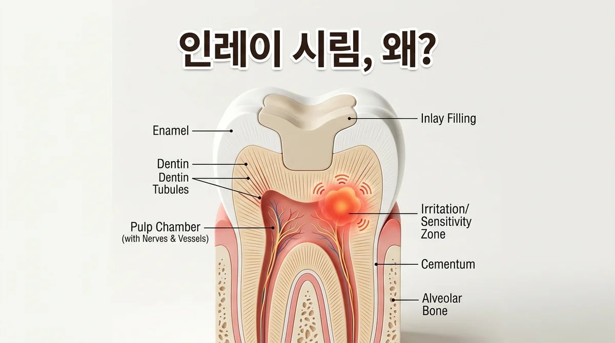 인레이 치료 후 칫솔질 시 시린 증상: 원인과 대처법