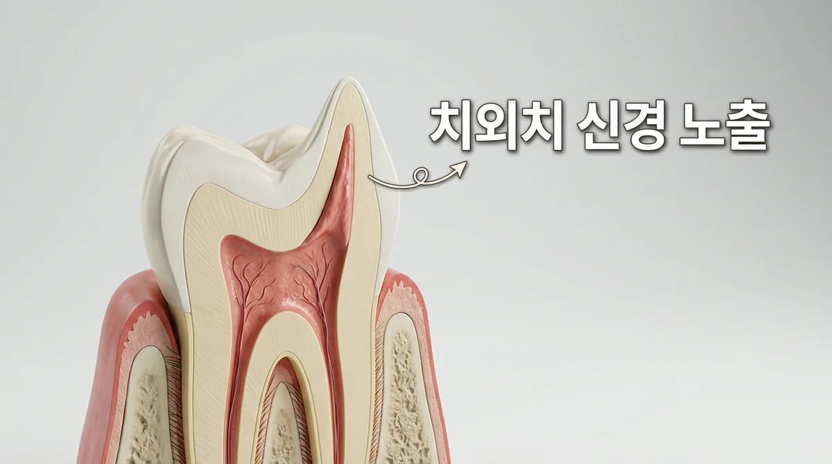 치외치 신경 노출: 원인과 성장 단계별 최신 치료 접근법 5가지