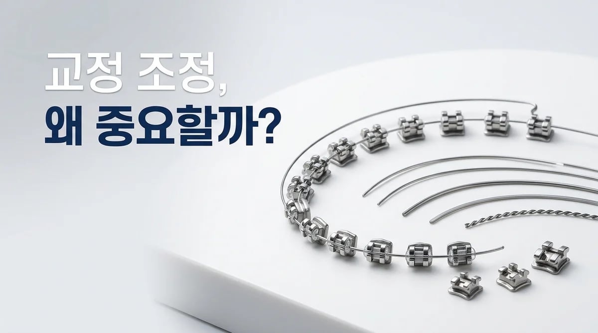 치아 교정 월치료: 왜 정기 조정 방문이 중요한가요? 3가지 핵심 이유