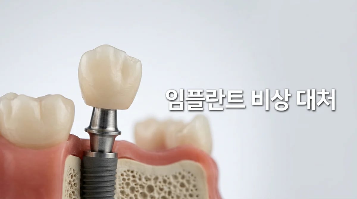 임플란트 보철물 문제 발생 시 대처법 5가지: 흔들림부터 빠짐까지