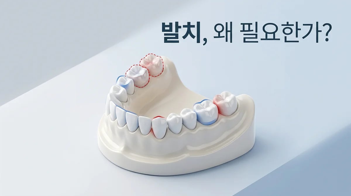 치아 교정 발치 결정 기준: 공간 확보부터 심미선까지 3가지 핵심