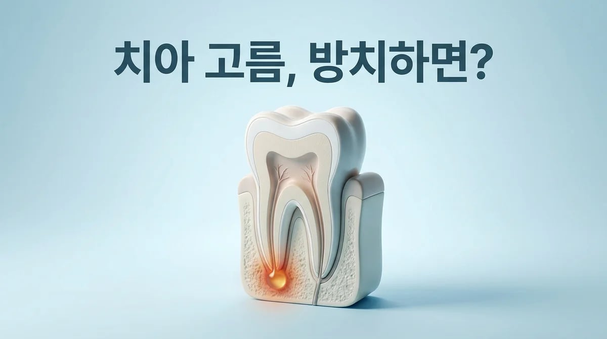 치아 고름, 방치하면? 잇몸 뼈 손상과 구강 건강 위험성 3가지