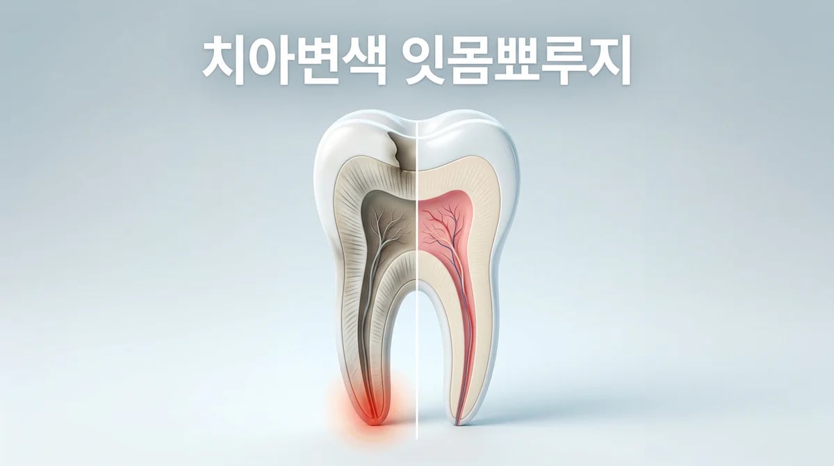 통증 없는 치아 변색과 잇몸 뾰루지: 치수괴사 신호 2가지