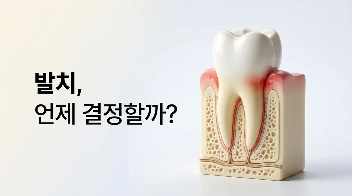 심한 잇몸 염증, 치아 발치 기준 4가지와 치료 방향성 가이드