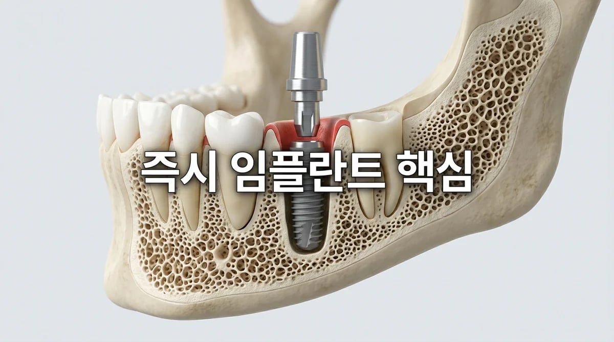 발치 즉시 임플란트 A to Z: 일반 임플란트와의 차이점 및 성공 조건