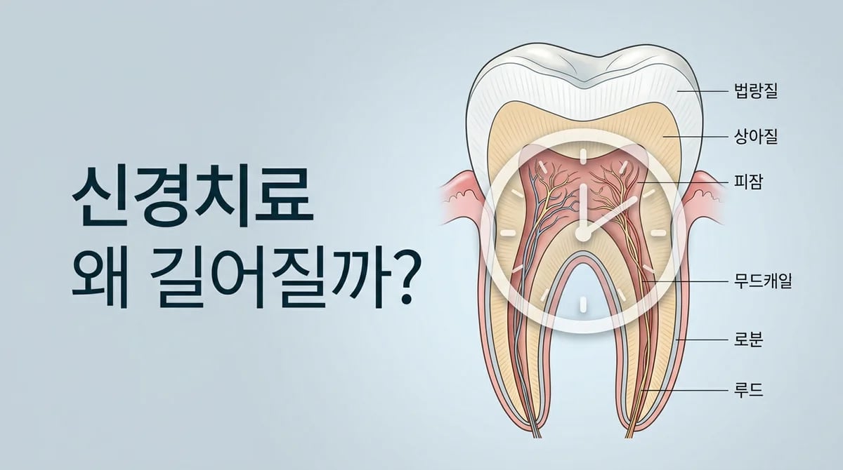 신경치료 기간, 왜 길어질까? 예상보다 오래 걸리는 4가지 이유
