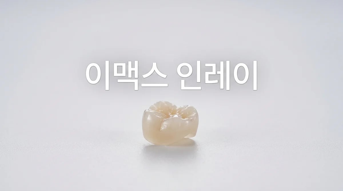 이맥스(E-max) 인레이 재료 선택: 치과 치료의 일반적 고려사항