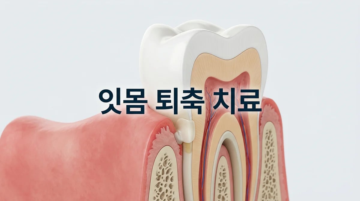 잇몸 퇴축으로 노출된 치아 뿌리, 레진과 G.I. 치료 가이드