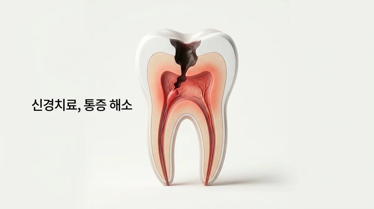 깊은 충치와 신경치료: 치수염 증상부터 진단, 치료 과정까지