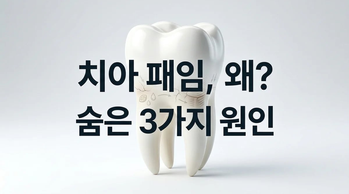 치경부 마모증의 진짜 원인: 칫솔질 외 숨겨진 압력 3가지 분석