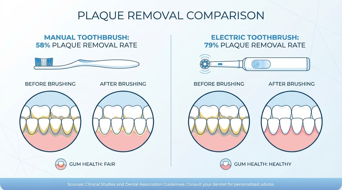 수동칫솔 58% vs 전동칫솔 79% 플라크 제거율을 비교하는 치아 건강 인포그래픽