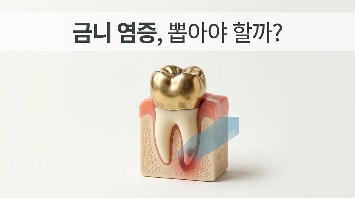 오래된 금 크라운 뿌리 염증: 임플란트 시점과 현명한 선택 기준