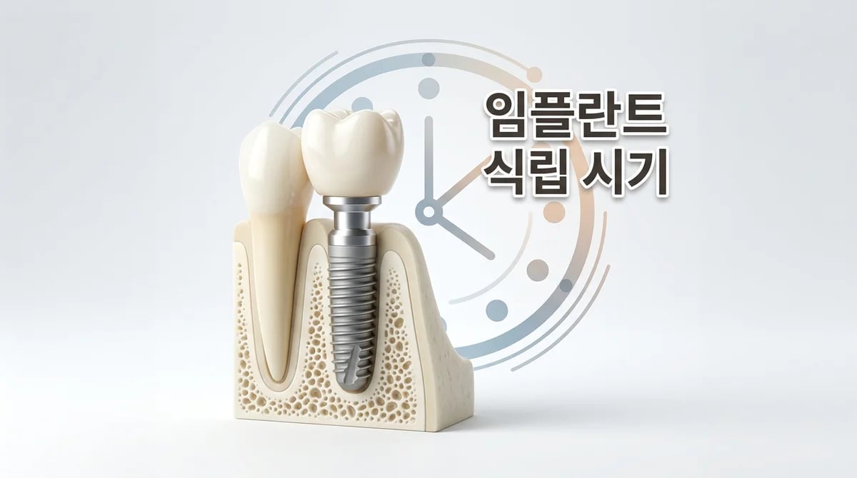 발치 후 임플란트, 언제 식립할까? 최적의 시기 4가지 유형
