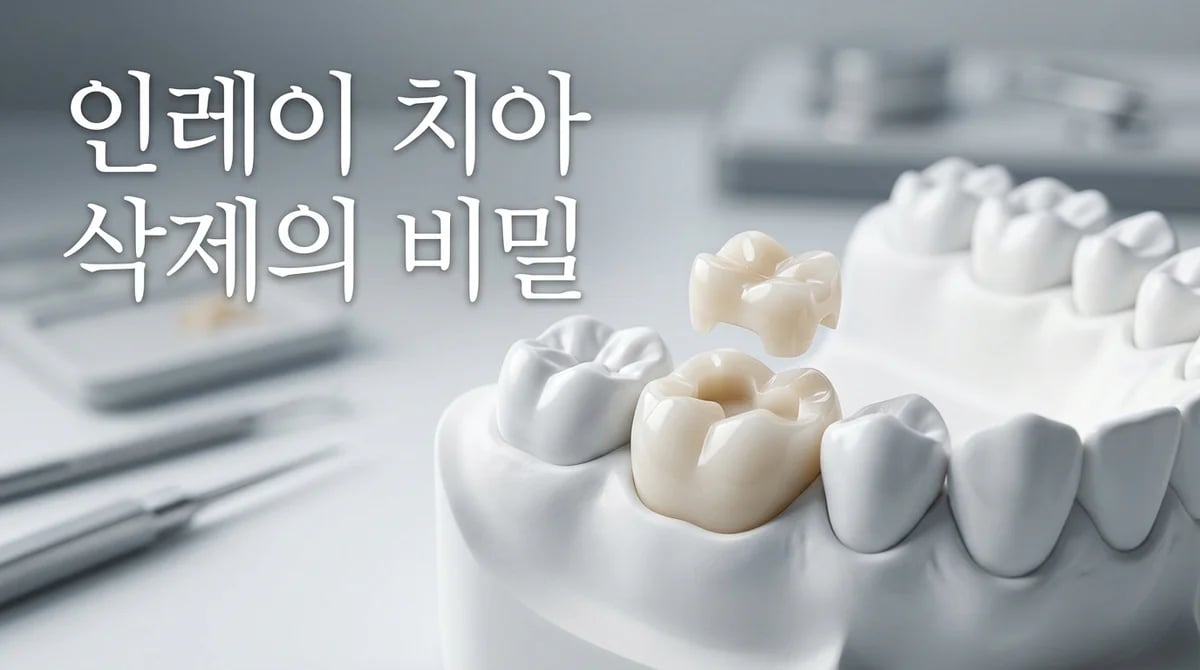 지르코니아 인레이 치아 삭제, 왜 중요할까요? 3가지 핵심 이해