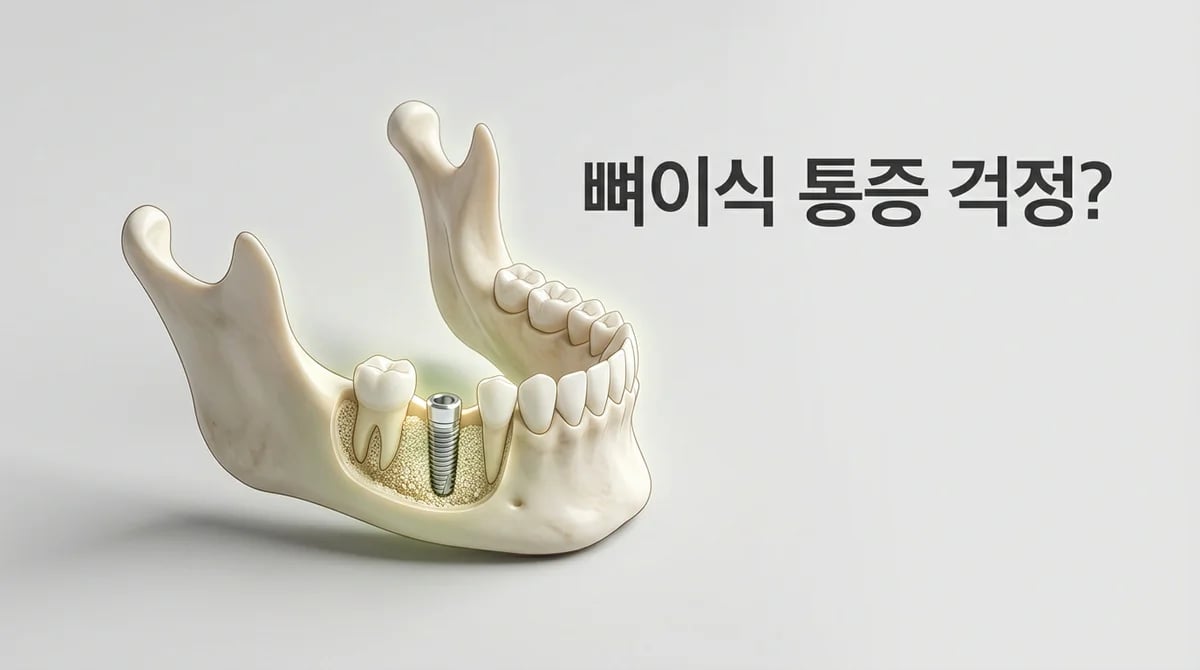 임플란트 치과 뼈이식 통증, 단계별 관리 및 회복 안내