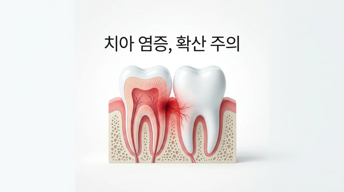 치아 염증, 주변 치아로 확산될까? 2가지 핵심 경로와 예방법