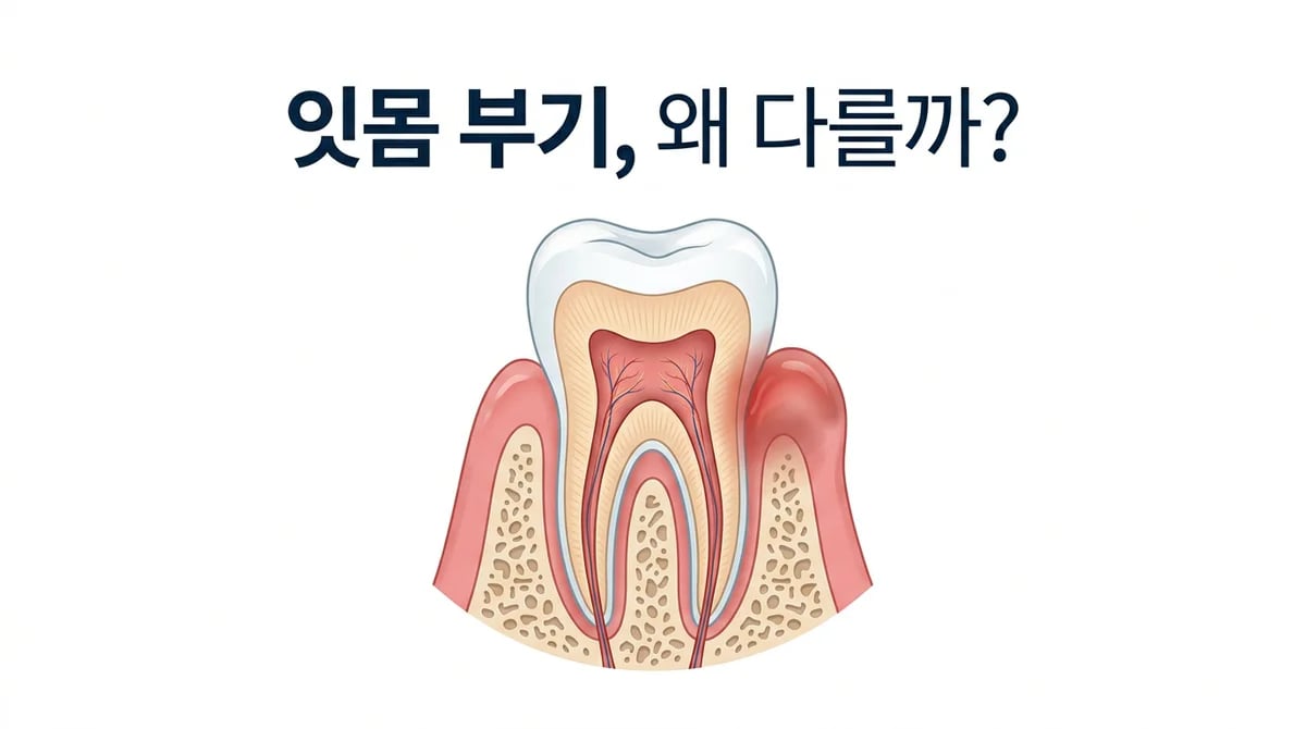 어금니 잇몸 염증과 부기: 증상별 원인과 올바른 대처법