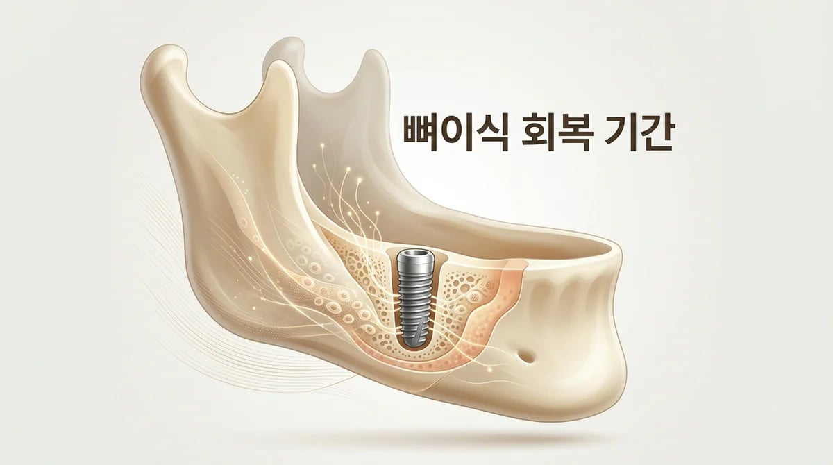 임플란트 뼈이식 후 회복 기간: 3단계 과학적 로드맵으로 이해하기