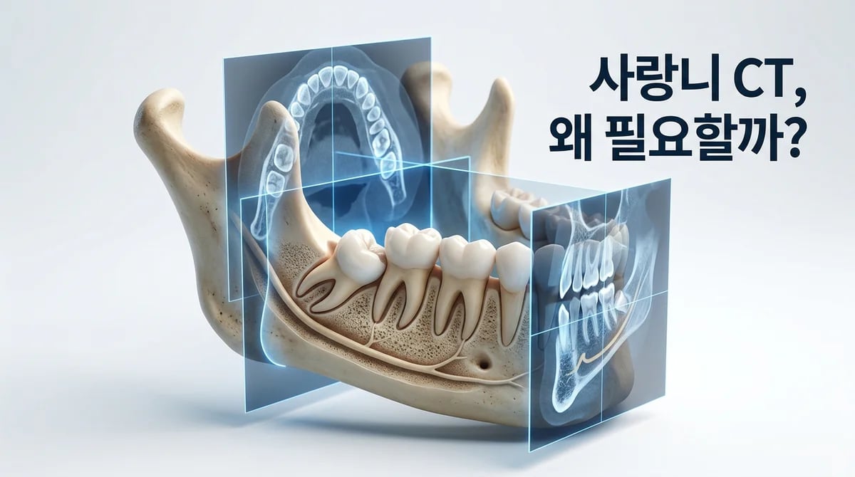 사랑니 발치 전 CT 촬영 필수? 3D 정밀 진단으로 안전 높이는 법