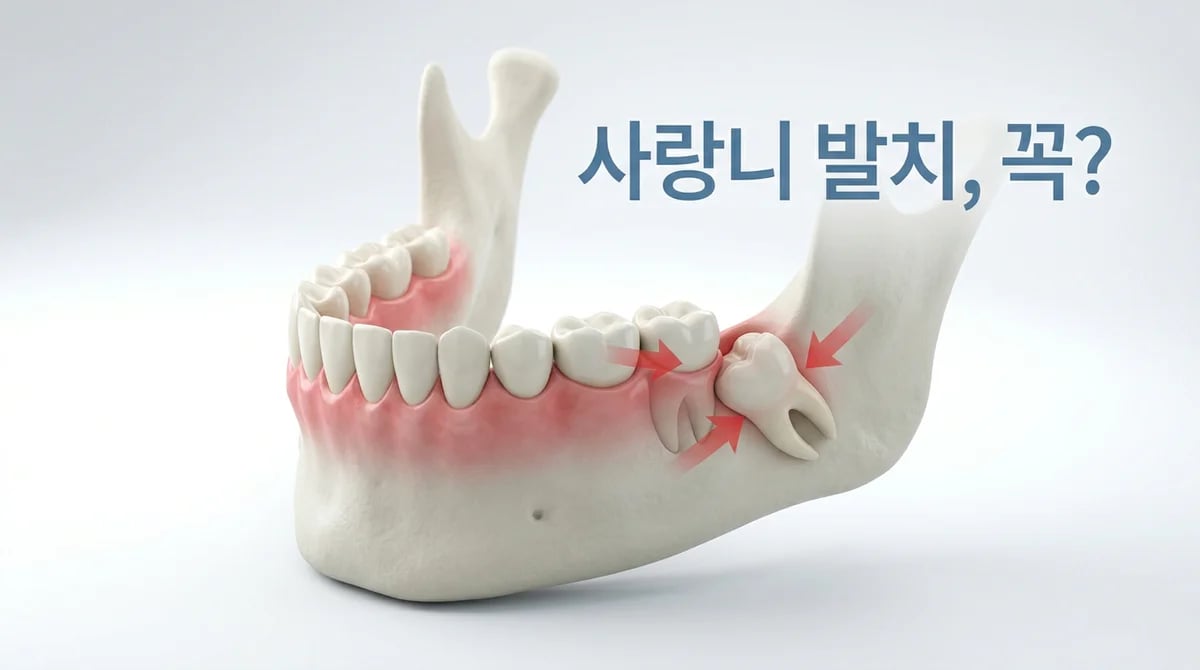 치아교정 전 사랑니 발치, 꼭 필요한 4가지 시나리오와 판단 기준