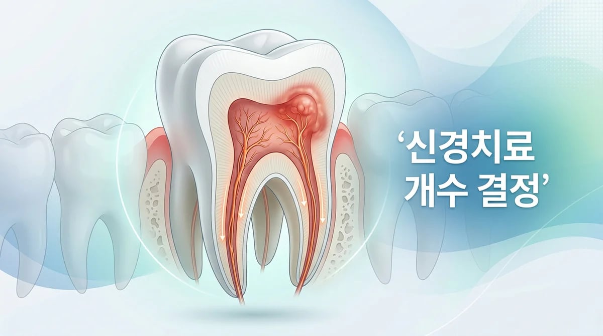 여러 치아 신경치료: 동시 진단 이유와 결정 과정 심층 분석