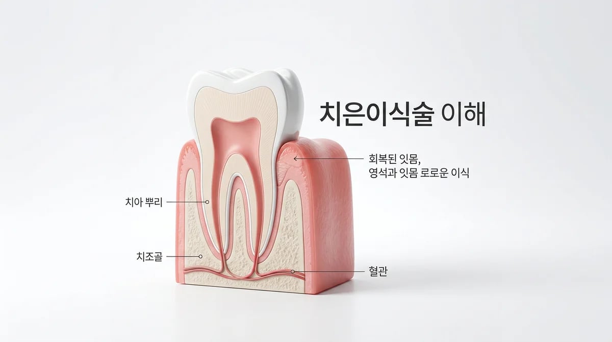 치은이식술: 잇몸 퇴축의 원인부터 시술 종류, 회복까지 완벽 가이드
