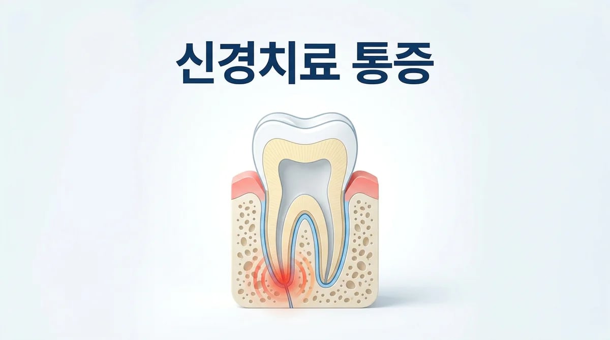 신경치료 후 통증, 왜 생길까? 원인 분석 및 현명한 대처법