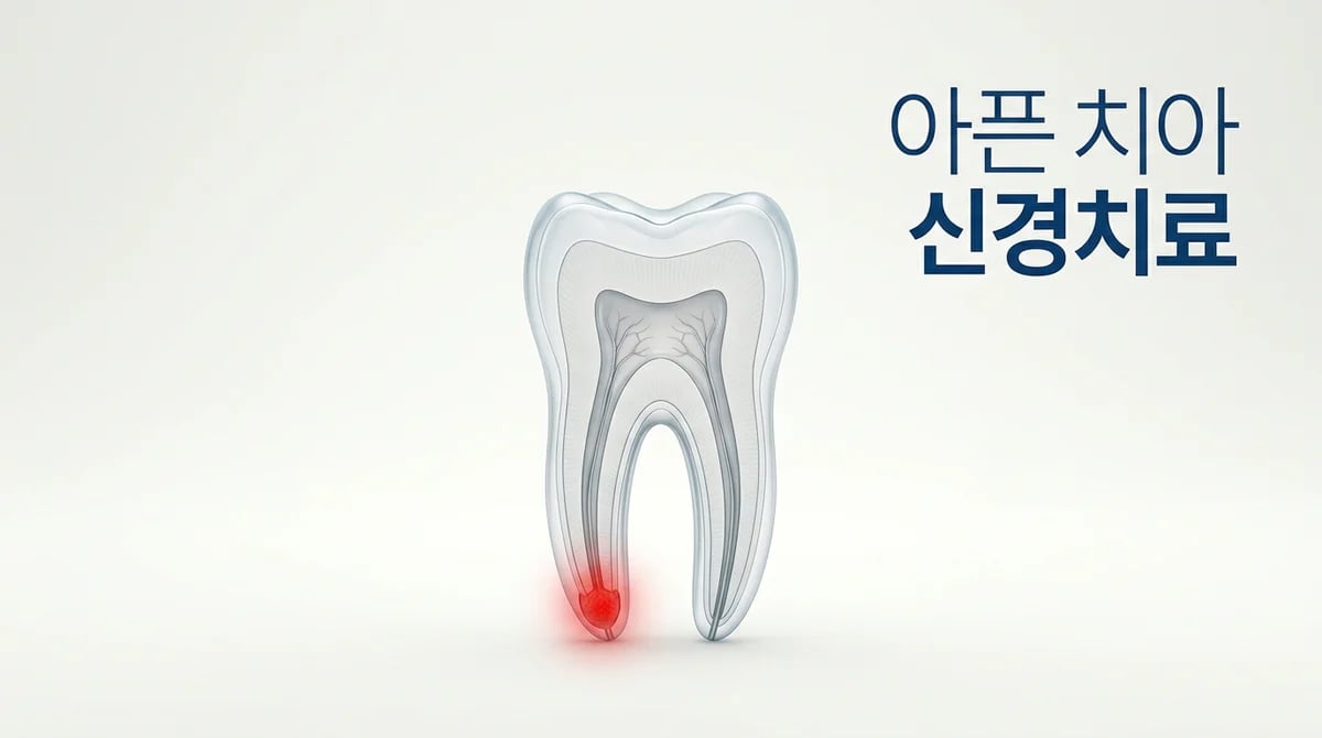 급성치근단치주염 신경치료: 통증 원인과 자연치아 보존 과정 상세 안내
