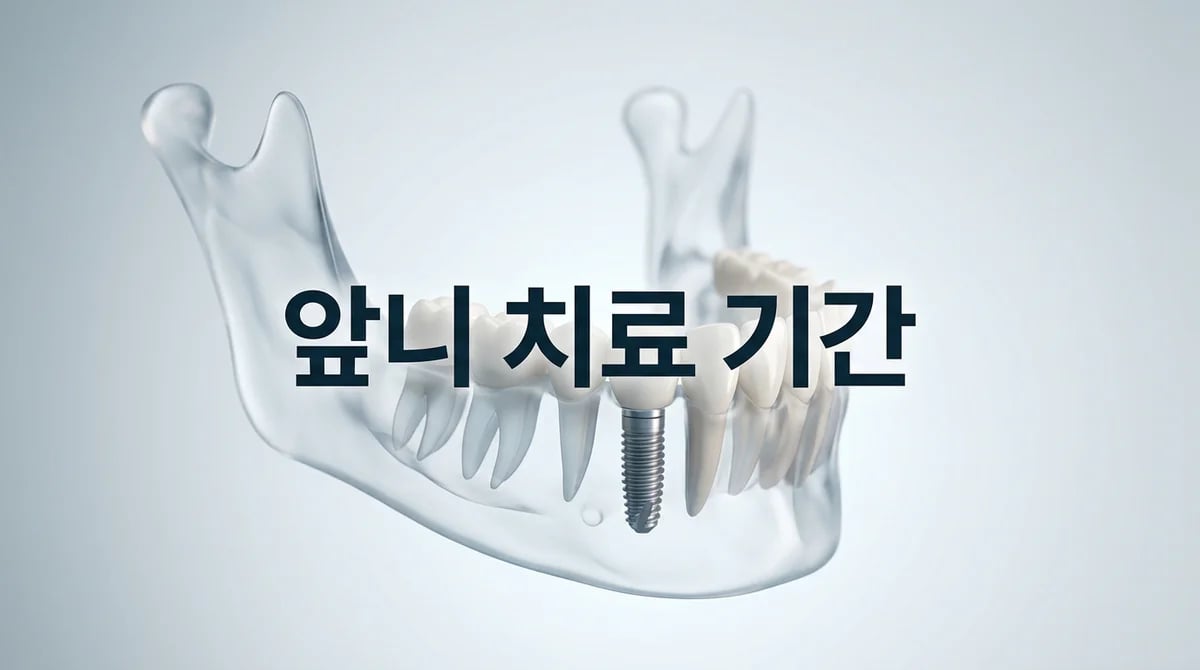 앞니 임플란트 vs 브릿지: 치료 과정과 예상 소요 기간 완벽 가이드