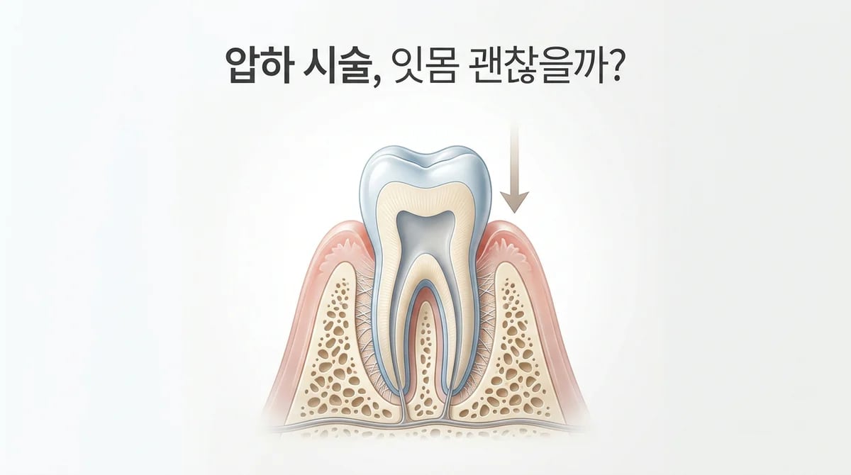 어금니 압하 시술과 치주염 위험: 잇몸 건강 관리 가이드