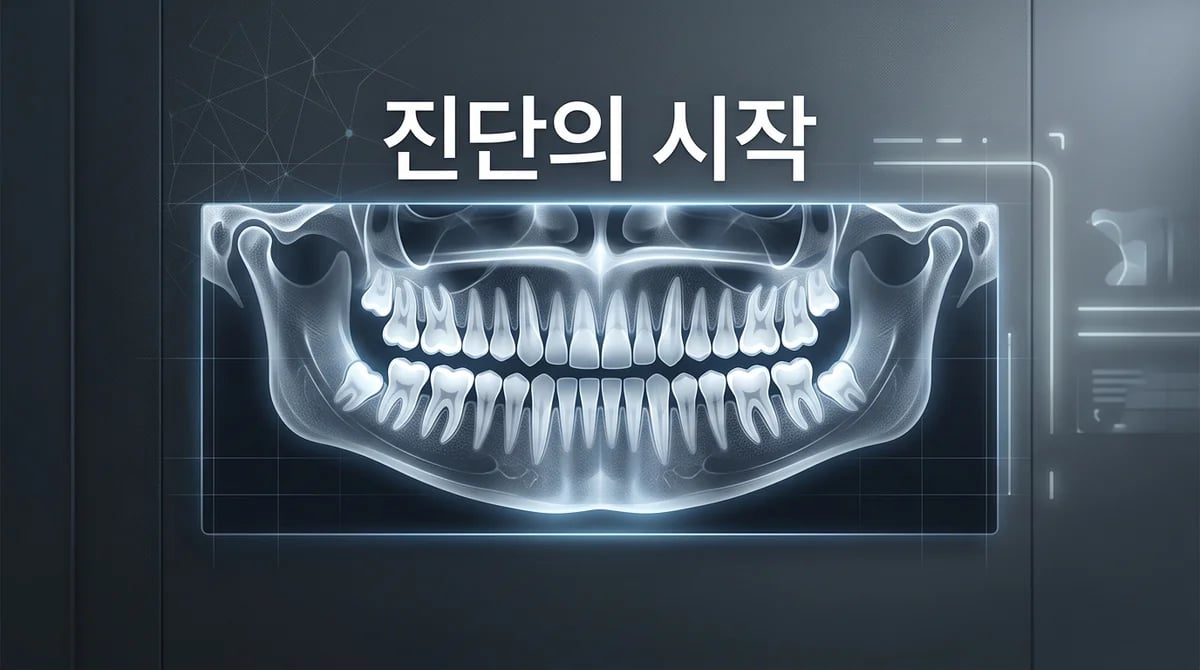 임플란트 파노라마 엑스레이: 성공적인 진단과 시술을 위한 핵심 정보