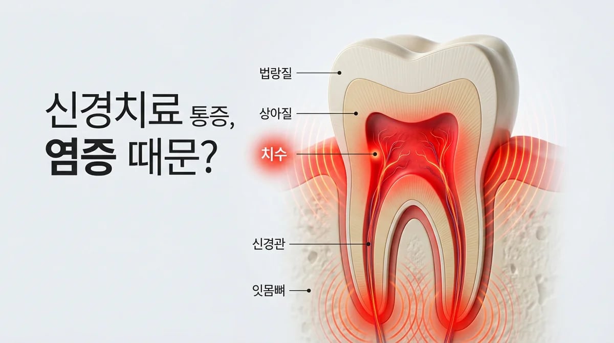 염증이 심할 때 신경치료 통증 심한 이유와 마취 효과 5가지