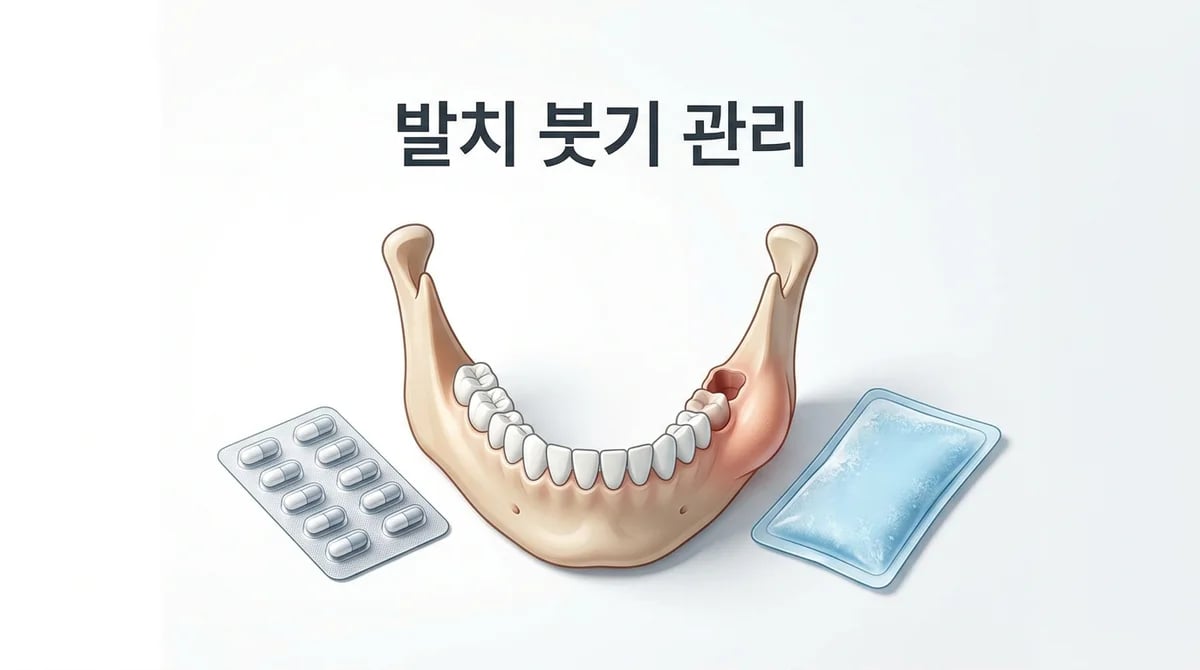 발치 후 붓기 관리 5단계: 항생제 복용 중요성과 회복 가이드