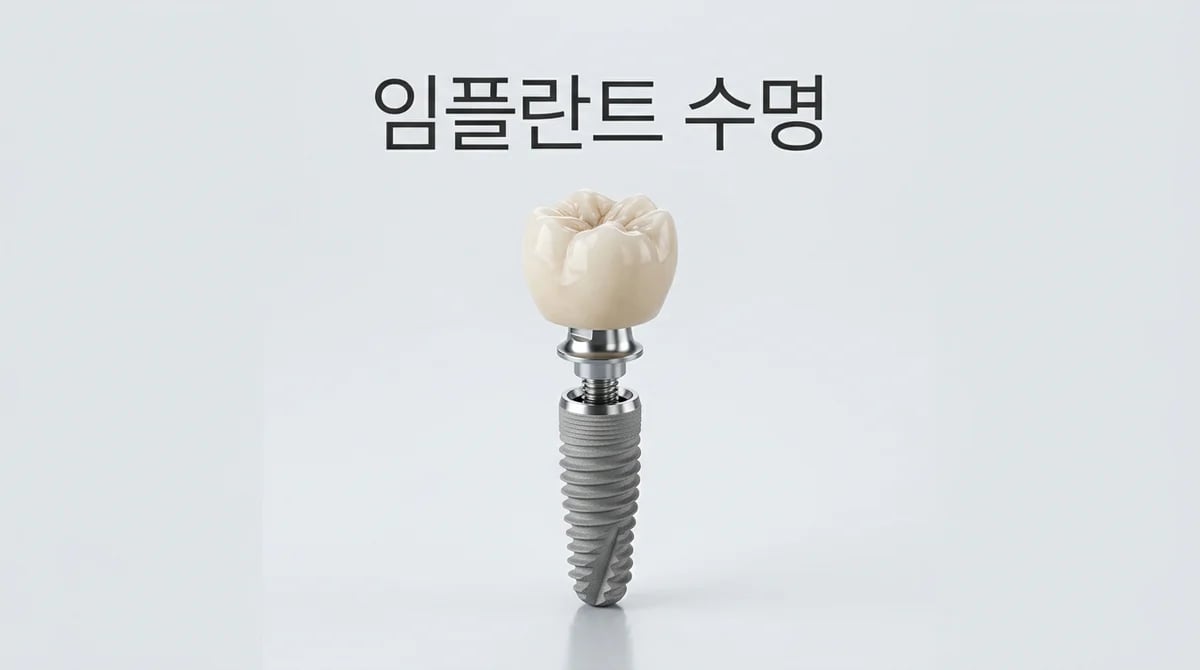 임플란트 수명, 오래 쓰는 5가지 핵심 요소와 관리법