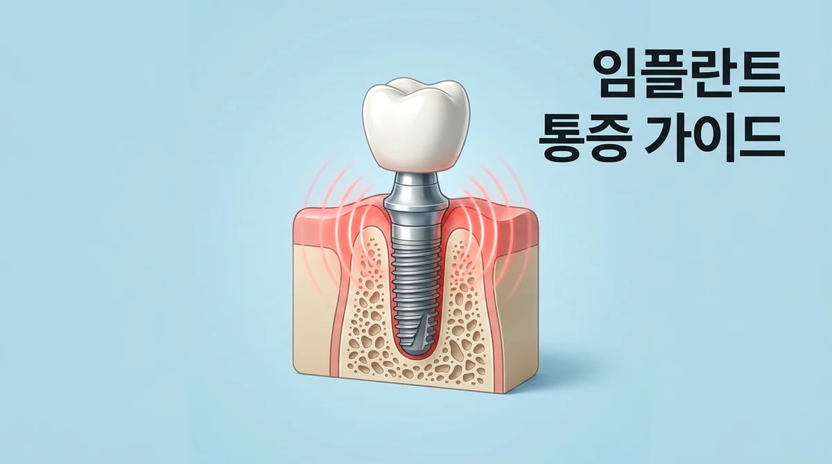 임플란트 시술 후 통증, 언제까지? 원인과 현명한 관리법 가이드
