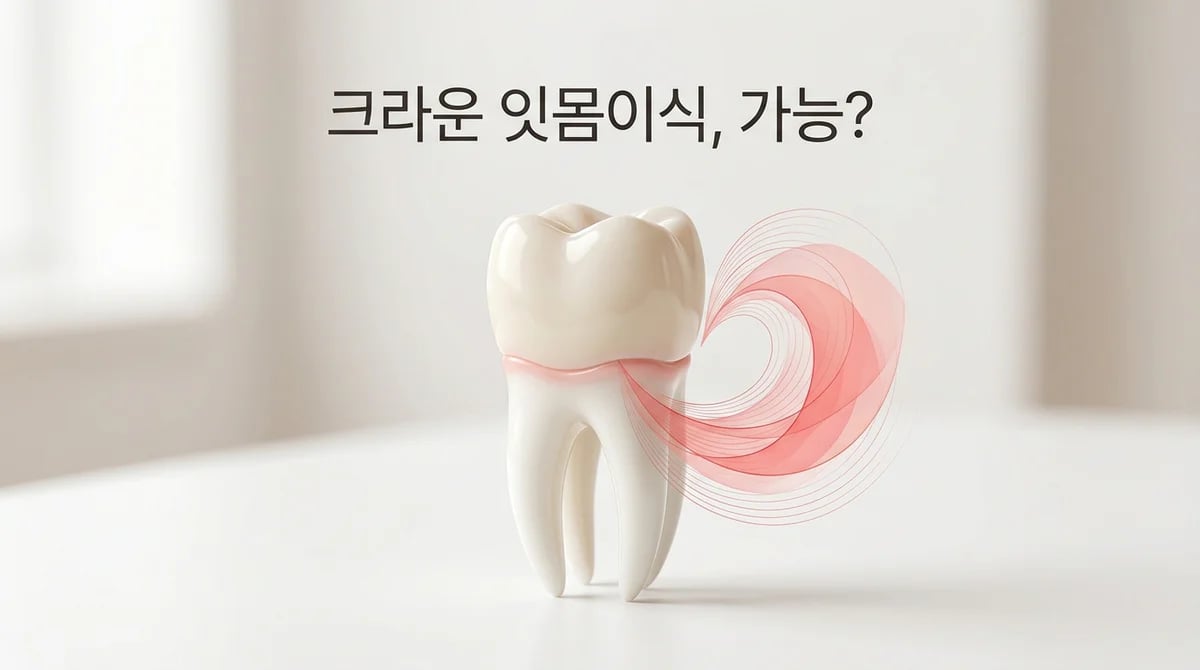 크라운 치아 잇몸이식, 가능한 조건과 성공을 위한 핵심 가이드
