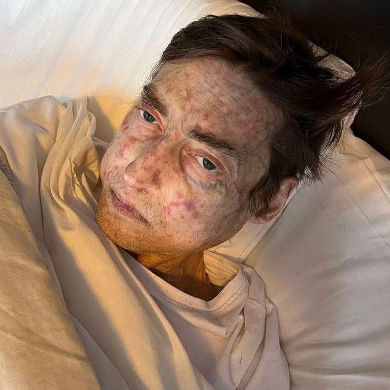 Павел после заболевания. Фото: Анна Дулевская / Facebook